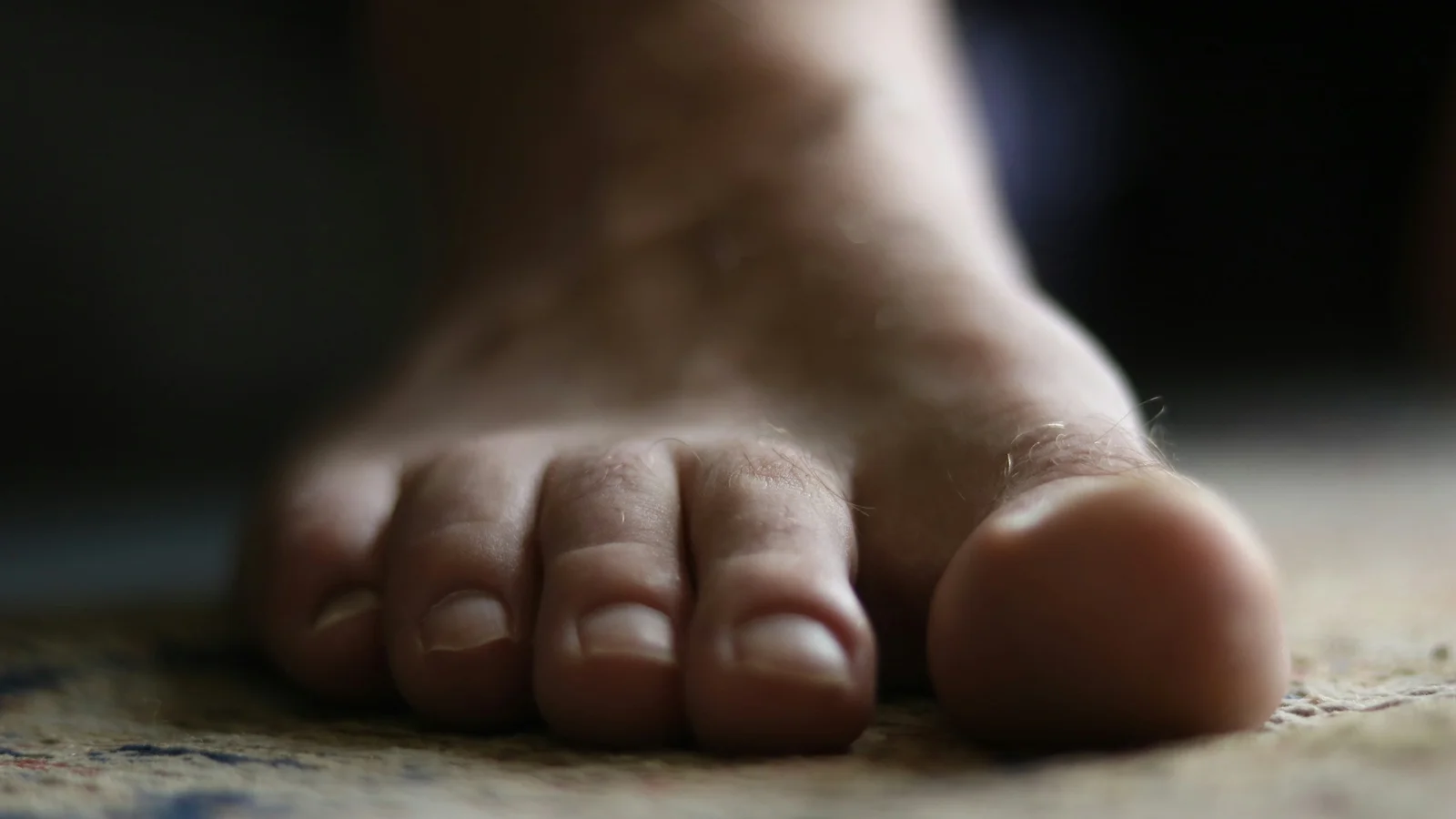 Hallux valgus behandeling door podotherapeut - scheve grote teen correctie